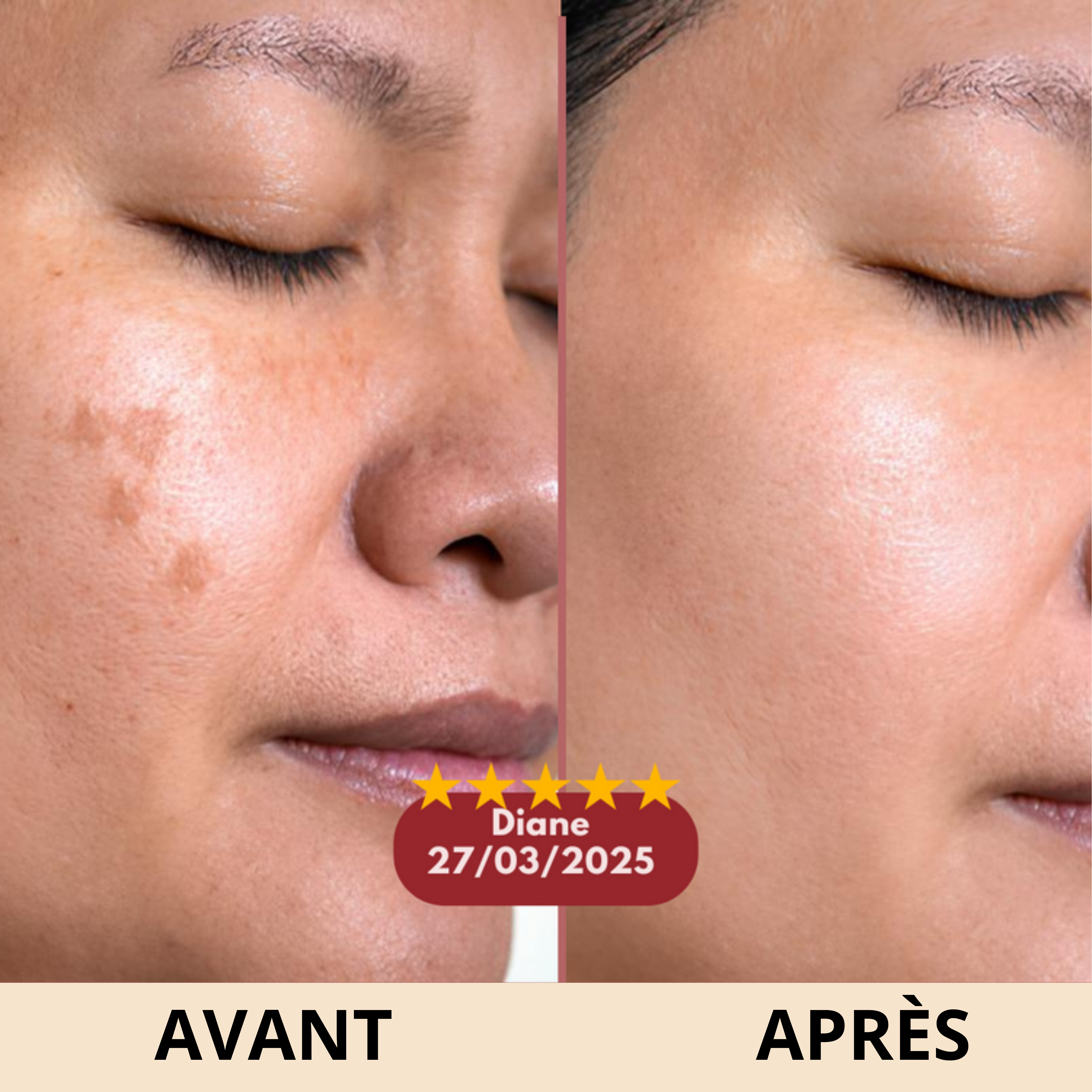 Stick Anti-Rides Calcium