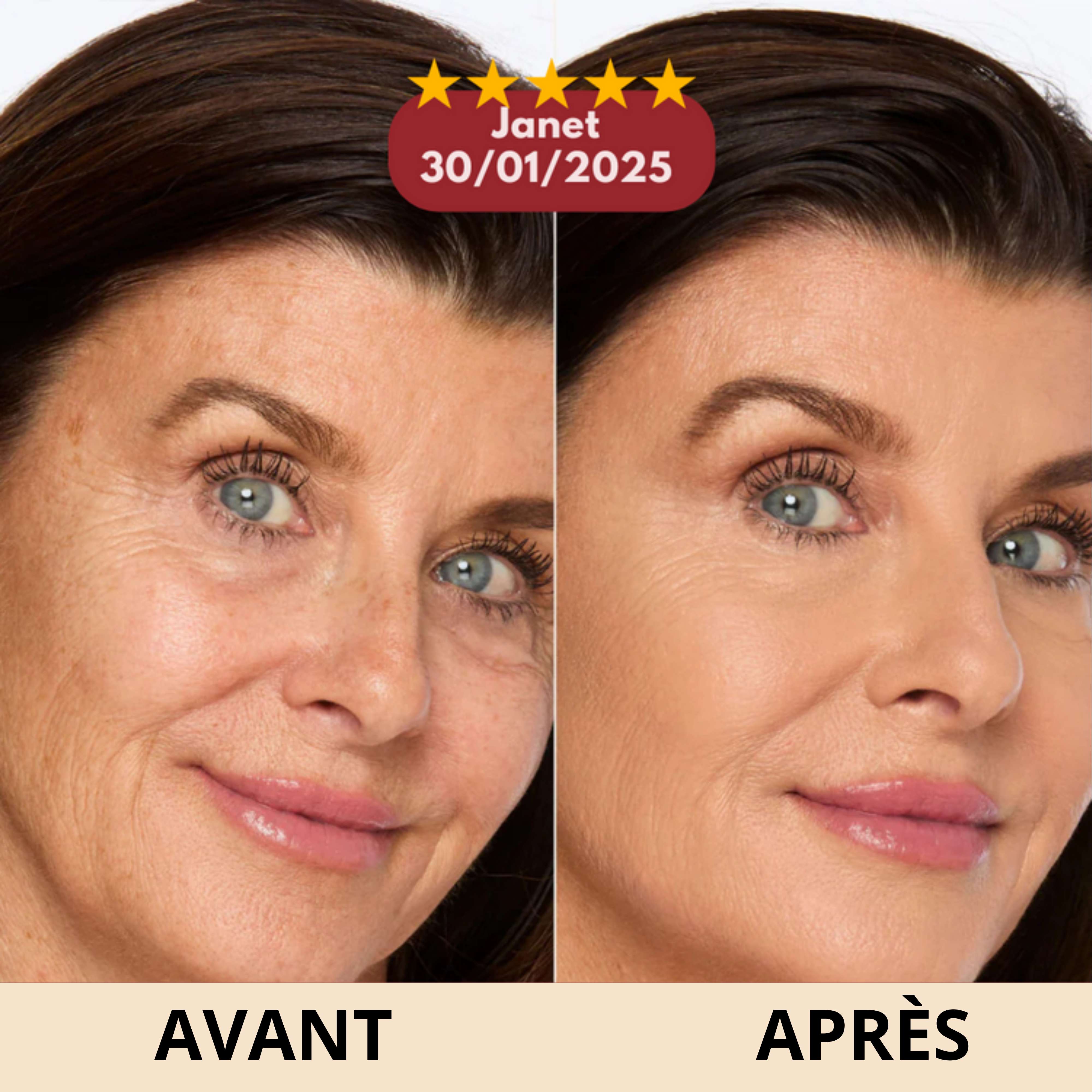 Stick Anti-Rides Calcium