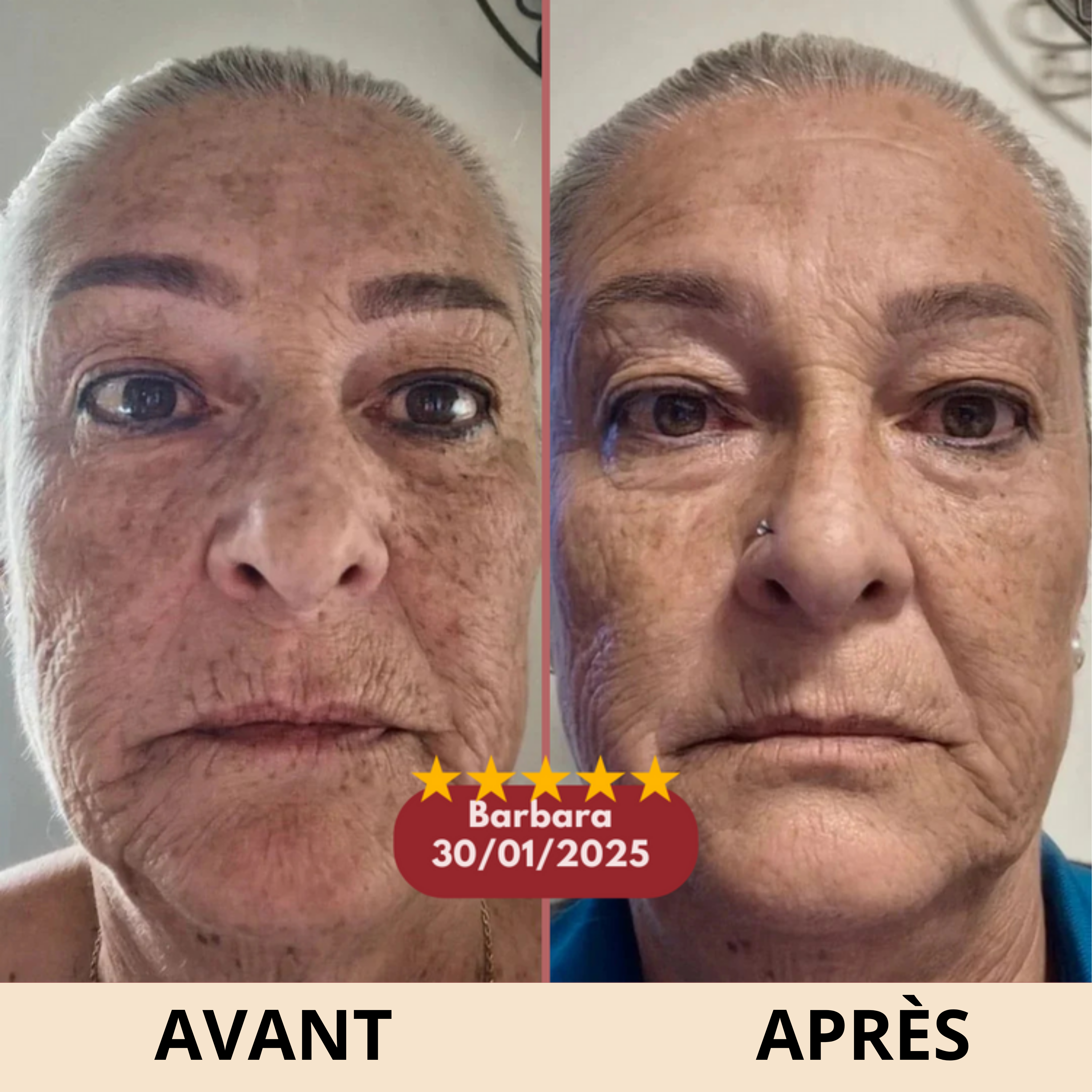 Stick Anti-Rides Calcium