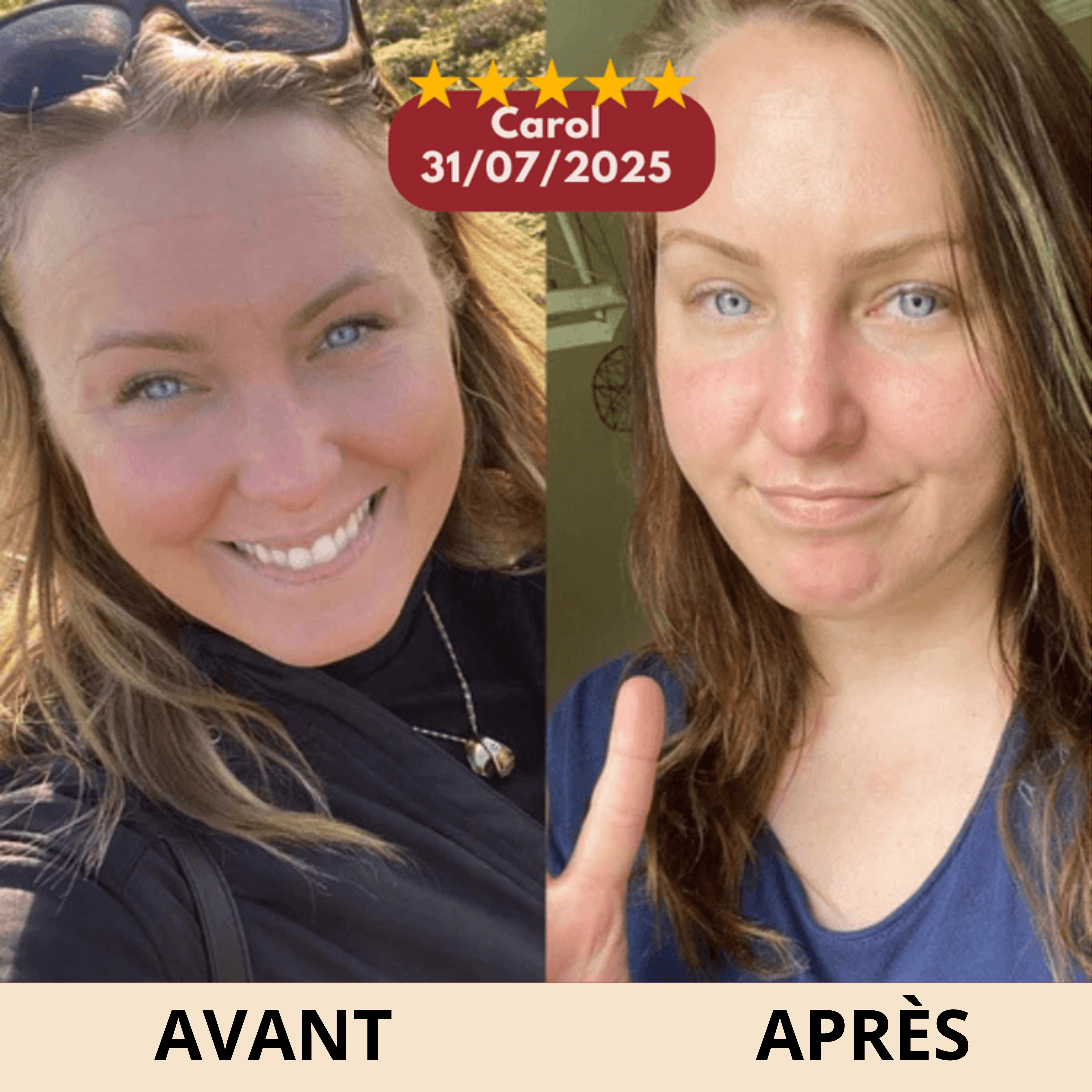 Stick Anti-Rides Calcium