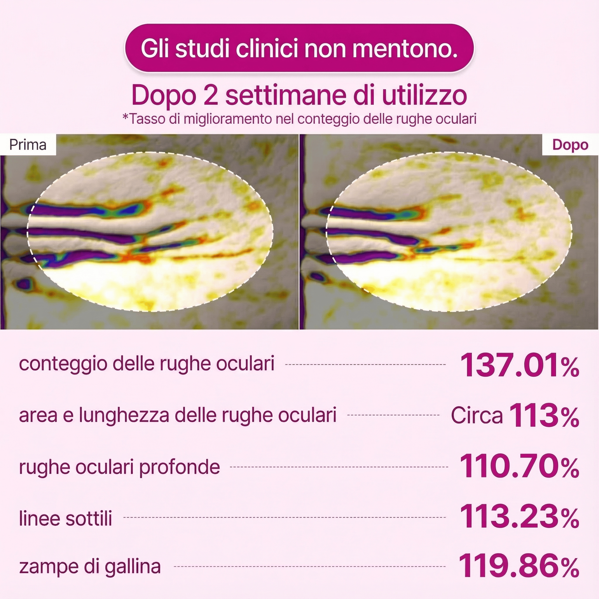 Patch Occhi al Calcio - 60 Pezzi